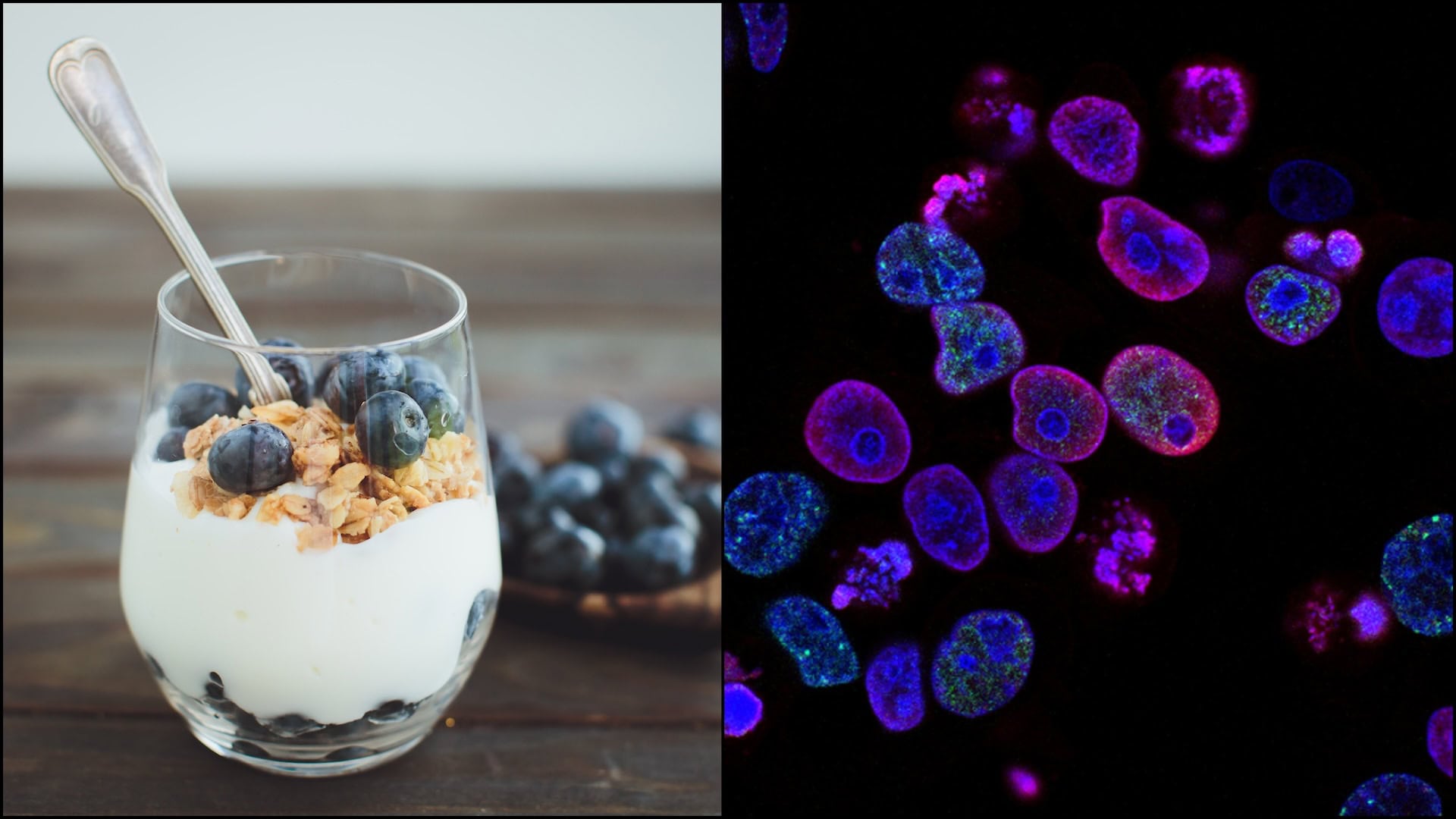 jogurt ako prevencia proti rakovine