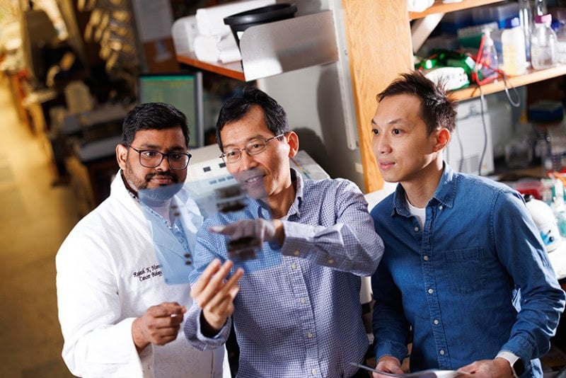 Hui-Kuan Lin, PhD, Fred a Janet Sanfilippovci, Rajeshkumar Manne, PhD, Che-Chia Hsu, PhD