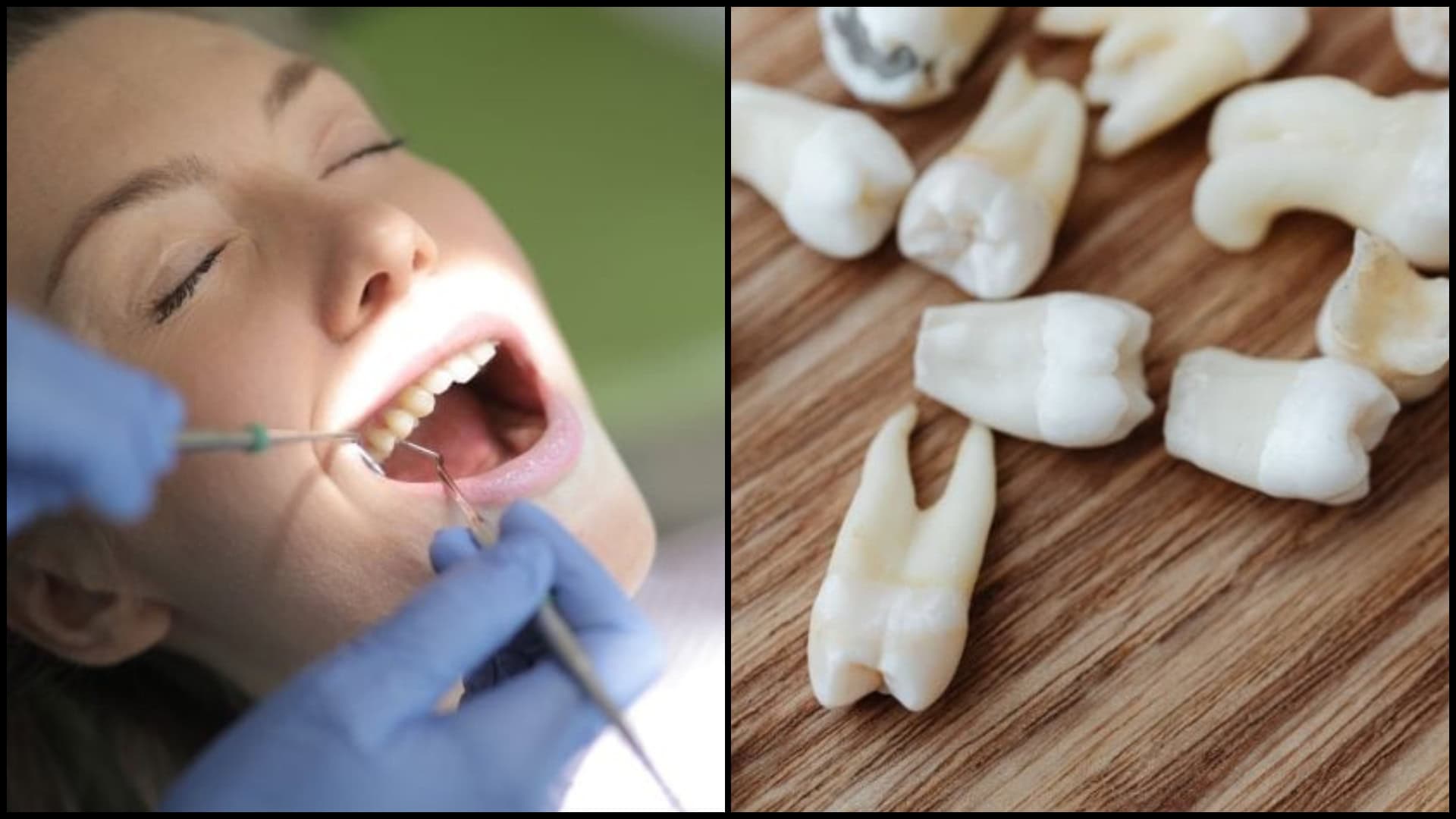 zázračný trik ako obnoviť zub