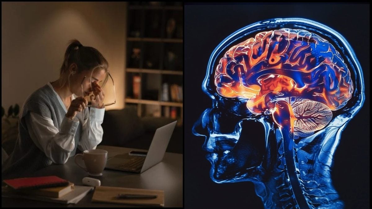 Dennodenne ho sledujeme úplne všetci. Vedci našli novodobého „zabijaka“ mozgu mozog a oci